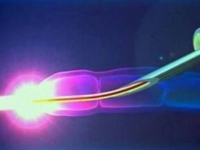 Laser w pracy